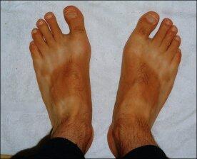 Teva feet
